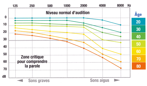 Audiogramme